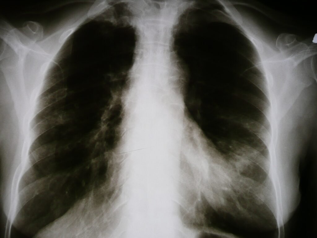 A chest X-ray image displayed for medical review